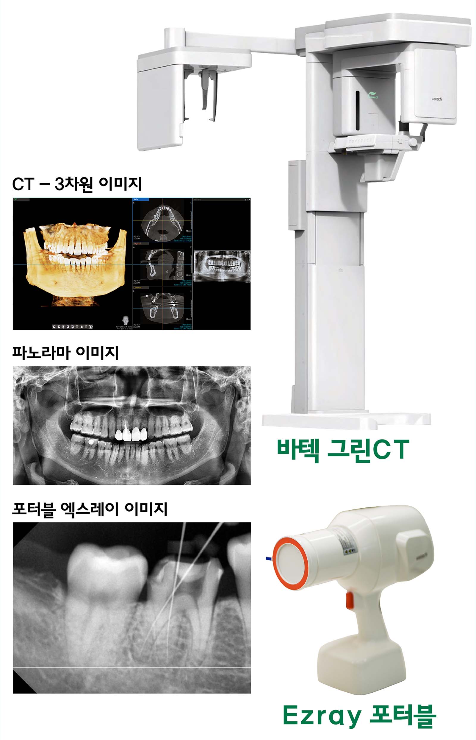 바텍 그린 CT와 eZray 포터블 사진